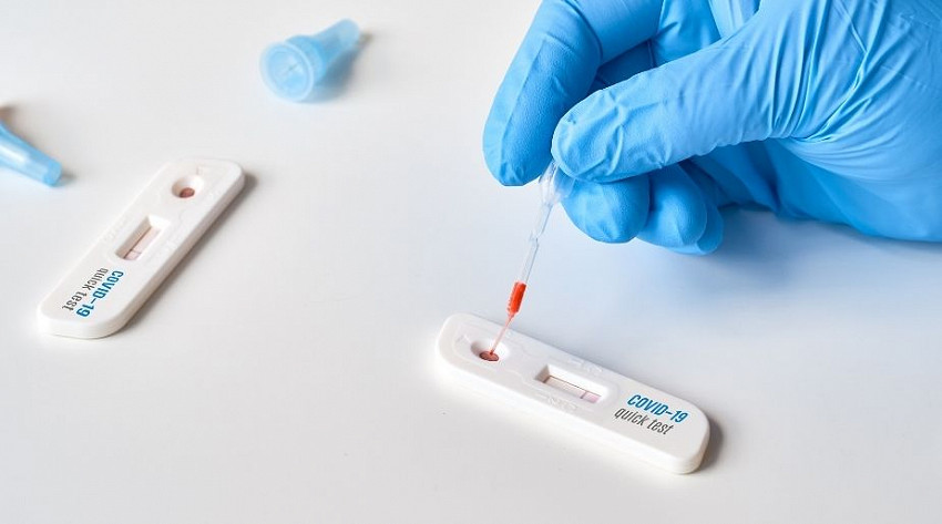 Rapid Coronavirus Test