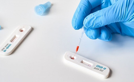 Doncaster businesses encouraged to register for lateral flow tests